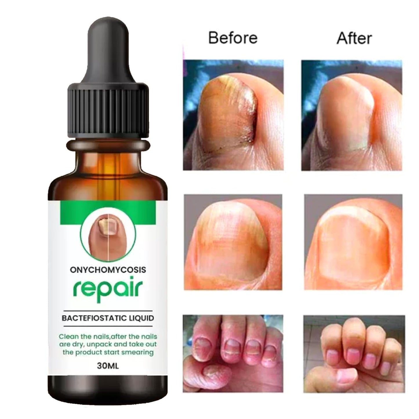 PureNail™ Growth & Recovery Drops
