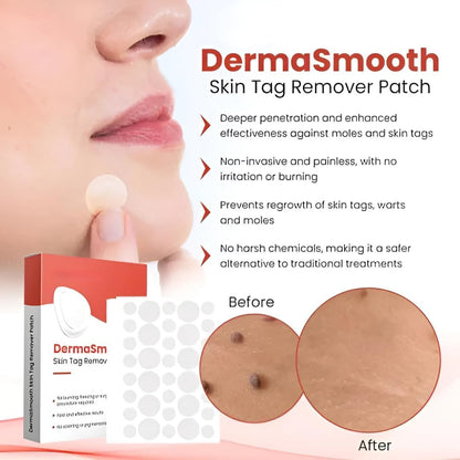 DermaPatch™ Skin Tag Remover